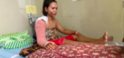 Cemburu buta suami siram istri dengan air keras seorang ibu muda di Kabupaten Bungo, Jambi yang berinisial MJ (25) menjadi korban